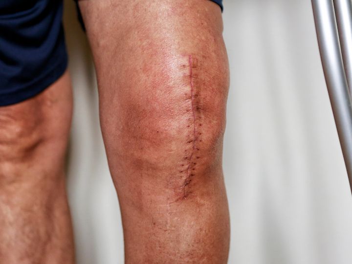 Post-Surgery Success: Why Recovery Starts at Home with Professional Therapy